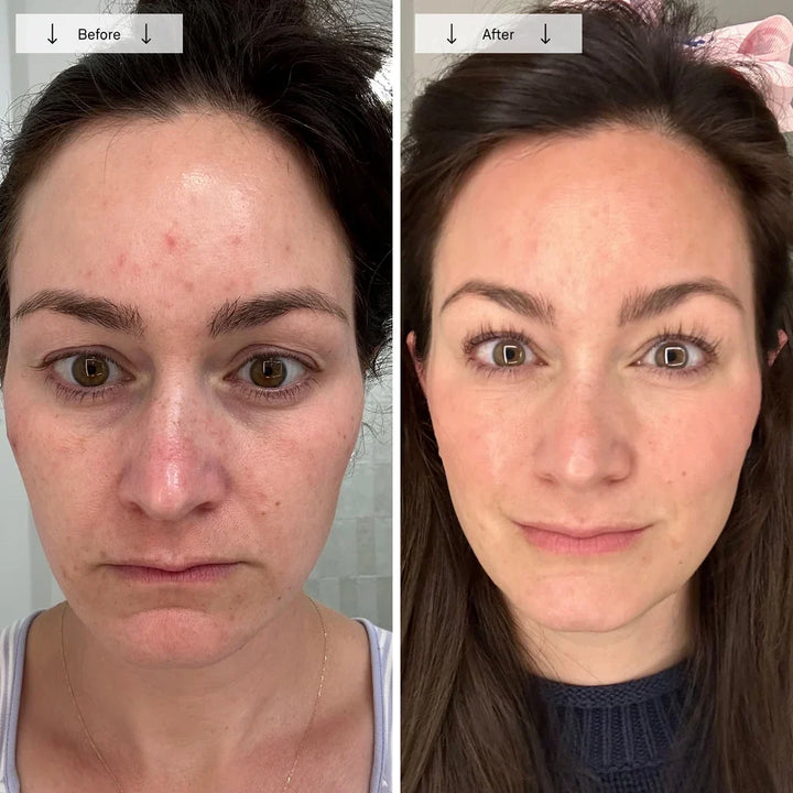 Red Light Therapy Face Mask for Wrinkles & Skin Rejuvenation